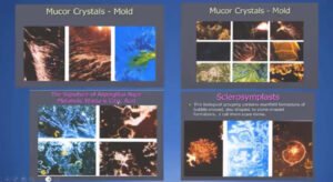 DARKFIELD MICROSCOPY THE WORLD NOW SEES EVIL INSIDE MANKIND